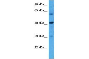Host:  Rat  Target Name:  HSD11B2  Sample Tissue:  Rat Liver  Antibody Dilution:  1ug/ml (HSD11B2 anticorps  (N-Term))