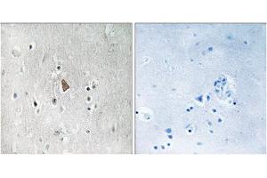 Immunohistochemistry analysis of paraffin-embedded human brain tissue, using Insulin Like Growth Factor 1 Receptor (IGF1R) (Phospho-Tyr1346) antibody. (IGF1R anticorps  (pTyr1346))