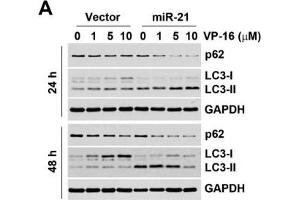 Effect of autophagy on miR-21-induced drug resistance.