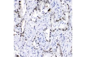 IHC analysis of hnRNP A2B1 using anti-hnRNP A2B1 antibody (ABIN5692872).