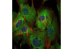 Immunofluorescence analysis of MSCS cells using BIRC5 antibody (green). (Survivin anticorps)