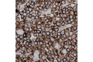 Immunohistochemical analysis of CD254 staining in human lymph node formalin fixed paraffin embedded tissue section. (RANKL anticorps  (Center))