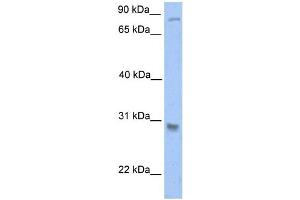 Western Blotting (WB) image for anti-Glutathione S-Transferase theta 1 (GSTT1) antibody (ABIN2459202) (GSTT1 anticorps)