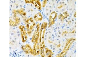 Immunohistochemistry of paraffin-embedded Rat kidney using SULT2A1 Polyclonal Antibody at dilution of 1:200 (40x lens).