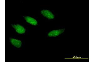 Immunofluorescence of purified MaxPab antibody to EGR2 on HeLa cell. (EGR2 anticorps  (AA 1-476))
