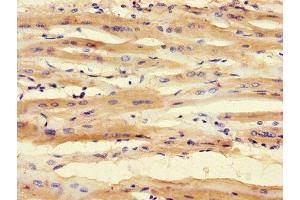 Immunohistochemistry of paraffin-embedded human heart tissue using ABIN7171028 at dilution of 1:100 (SMNDC1 anticorps  (AA 1-238))