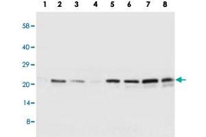 Western blot analysis of tissue and whole cell extracts with SOCS2 polyclonal antibody . (SOCS2 anticorps  (C-Term))