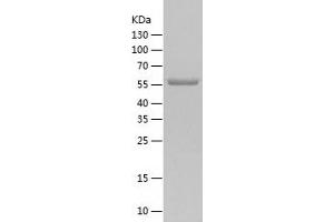 Western Blotting (WB) image for Regulator of G-Protein Signaling 14 (RGS14) (AA 1-566) protein (His tag) (ABIN7124814) (RGS14 Protein (AA 1-566) (His tag))