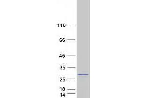 Validation with Western Blot