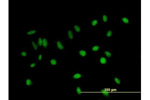 Immunofluorescence of purified MaxPab antibody to C11orf17 on HeLa cell.