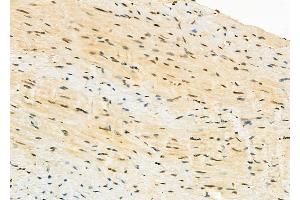 ABIN6263011 and ABIN6273265 at 1/100 staining Mouse heart tissue by IHC-P. (LRPPRC anticorps  (Internal Region))