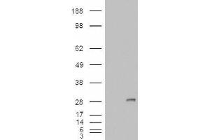 HEK293 overexpressing IGFBP6 and probed with ABIN2563362 (mock transfection in first lane). (IGFBP6 anticorps  (Internal Region))