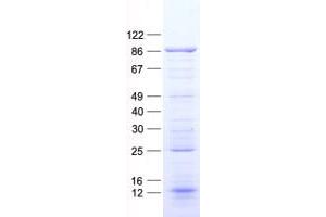 Validation with Western Blot (Glycogen Synthase Protein (GYS) (His tag))