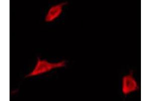 ABIN6272350 staining COLO205 by IF/ICC.