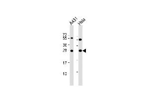 All lanes : Anti-PSPH Antibody (N-term) at 1:8000 dilution Lane 1: A431 whole cell lysate Lane 2: Hela whole cell lysate Lysates/proteins at 20 μg per lane. (PSPH anticorps  (N-Term))