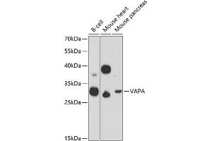 Western blot analysis of extracts of various cell lines, using VAPA Antibody (ABIN6132892, ABIN6150056, ABIN6150057 and ABIN6216758) at 1:3000 dilution. (VAPA anticorps  (AA 137-227))