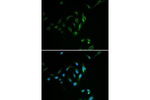 Immunofluorescence analysis of MCF7 cell using CPT2 antibody.