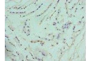 Immunohistochemistry (IHC) image for anti-Arginase, Type II (ARG2) (AA 1-354) antibody (ABIN6098038)