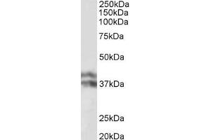 ABIN870672 (0. (HP beta Chain (Internal Region) anticorps)
