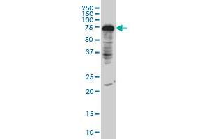 DCP1A monoclonal antibody (M06), clone 3G4 Western Blot analysis of DCP1A expression in IMR-32 (DCP1A anticorps  (AA 186-285))
