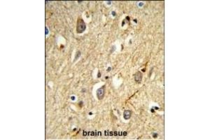 Formalin-fixed and paraffin-embedded human brain tissue reacted with RAB8A Antibody, which was peroxidase-conjugated to the secondary antibody, followed by DAB staining.
