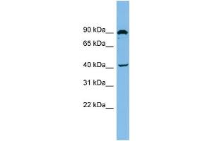 WB Suggested Anti-ZMYND12 Antibody Titration: 0. (ZMYND12 anticorps  (N-Term))