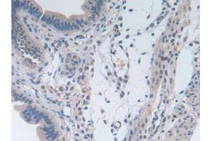 IHC-P analysis of Mouse Uterus Tissue, with DAB staining. (IL-2 anticorps  (AA 10-169))