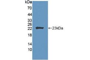 Western blot analysis of recombinant Human LCAT. (LCAT anticorps  (AA 41-210))