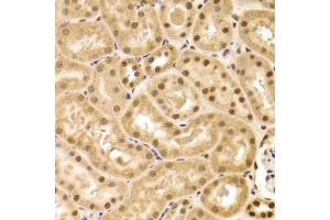 Immunohistochemistry of paraffin-embedded mouse kidney using ANP32A Antibody.