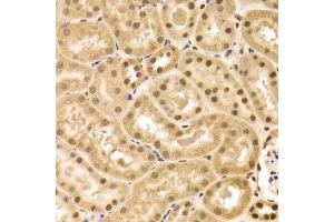 Immunohistochemistry of paraffin-embedded mouse kidney using ANP32A Antibody. (PHAP1 anticorps  (AA 1-170))