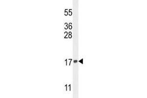 Western blot analysis of Histone H3. (Histone H3.3 anticorps  (Lys9))