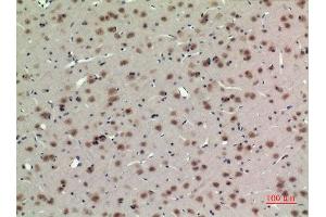 Immunohistochemistry (IHC) analysis of paraffin-embedded Rat Brain, antibody was diluted at 1:100.