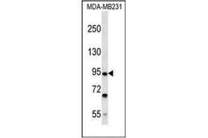 Western blot analysis of FSD2 Antibody (N-term) in MDA-MB231 cell line lysates (35ug/lane). (FSD2 anticorps  (N-Term))