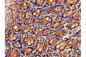 Immunohistochemistry of paraffin-embedded human small intestine tissue using ABIN7161885 at dilution of 1:100 (PPP1R9A anticorps  (AA 1-243))