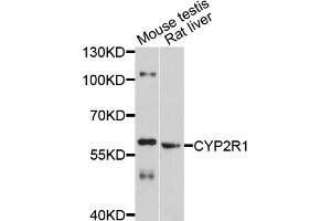 Western blot analysis of extracts of various cell lines, using CYP2R1 antibody (ABIN4903430) at 1:1000 dilution. (CYP2R1 anticorps)