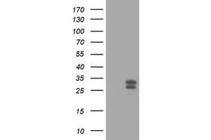 Image no. 4 for anti-O6-Methylguanine-DNA-Methyltransferase (MGMT) antibody (ABIN1499456) (MGMT anticorps)