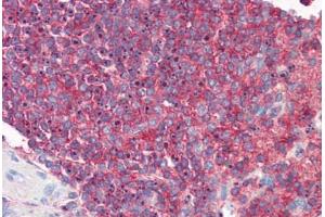 Human Spleen: Formalin-Fixed, Paraffin-Embedded (FFPE) (ICAM-3/CD50 anticorps)