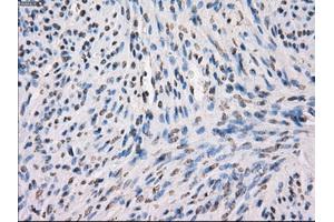 Immunohistochemical staining of paraffin-embedded Ovary tissue using anti-MAP2K1 mouse monoclonal antibody. (MEK1 anticorps)