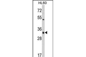 Western blot analysis of HLA-DRA Antibody (C-term) (ABIN390771 and ABIN2841029) in HL60 cell line lysates (35 μg/lane). (HLA-DRA anticorps  (C-Term))