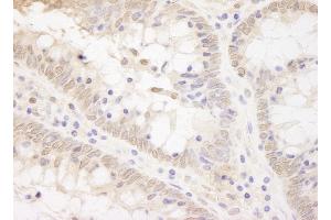 Immunohistochemistry (IHC) image for anti-Transcription Factor 12 (TCF12) (AA 1-50) antibody (ABIN7448827)