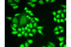 Immunofluorescence analysis of MCF-7 cells using RNF40 antibody (ABIN5973843).