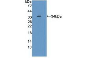 Detection of Recombinant RPS6Ka1, Human using Polyclonal Antibody to Ribosomal Protein S6 Kinase Alpha 1 (RPS6Ka1) (RPS6KA1 anticorps  (AA 62-321))