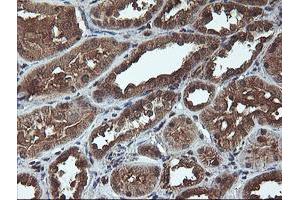 Immunohistochemical staining of paraffin-embedded Human Kidney tissue using anti-C1S mouse monoclonal antibody. (C1S anticorps)