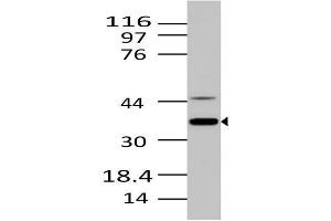Image no. 1 for anti-MKI67 FHA Domain-Interacting Nucleolar Phosphoprotein (MKI67IP) (AA 90-210) antibody (ABIN5027395) (NIFK anticorps  (AA 90-210))