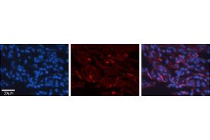 Rabbit Anti-H6PD Antibody     Formalin Fixed Paraffin Embedded Tissue: Human Lung Tissue  Observed Staining: Cytoplasmic in alveolar type I cells  Primary Antibody Concentration: 1:100  Other Working Concentrations: 1/600  Secondary Antibody: Donkey anti-Rabbit-Cy3  Secondary Antibody Concentration: 1:200  Magnification: 20X  Exposure Time: 0.