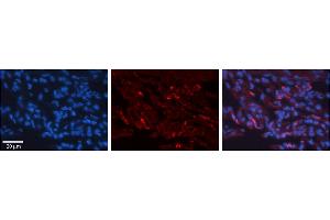 Rabbit Anti-H6PD Antibody     Formalin Fixed Paraffin Embedded Tissue: Human Lung Tissue  Observed Staining: Cytoplasmic in alveolar type I cells  Primary Antibody Concentration: 1:100  Other Working Concentrations: 1/600  Secondary Antibody: Donkey anti-Rabbit-Cy3  Secondary Antibody Concentration: 1:200  Magnification: 20X  Exposure Time: 0. (Glucose-6-Phosphate Dehydrogenase anticorps  (N-Term))