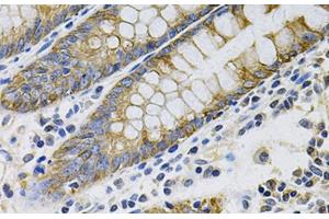 Immunohistochemistry of paraffin-embedded Human colon using KRT20 Polyclonal Antibody at dilution of 1:100 (40x lens). (KRT20 anticorps)