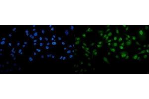 IF analysis of METTL3 using anti-METTL3 antibody (ABIN7602808). (METTL3 anticorps  (C-Term))