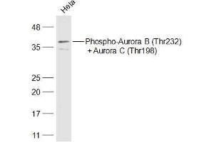 Hela lysates probed with Phospho-Aurora B (Thr232) + Aurora C (Thr198) Polyclonal Antibody, Unconjugated  at 1:500 dilution and 4˚C overnight incubation.