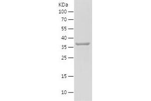 Western Blotting (WB) image for phosphoserine Aminotransferase 1 (PSAT1) (AA 70-191) protein (His-IF2DI Tag) (ABIN7124448)